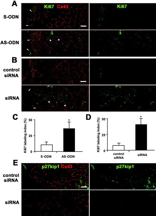 Cx43 AS-ODN or siRNA increased the proliferative activity of the rat corneal endothelium after scrape injury. (A, B) Double immunolabeling for Ki67 and Cx43 in a surface preparation on day 1 after injury (wounds on the left) revealed that not only small, elongated cells at the border of the wound (arrowheads), but also enlarged irregular-shaped endothelial cells ( ) on the periphery of the wound were Ki67-positive in the corneas treated with AS-ODN (A) or siRNA (B). In contrast, only small, elongated cells at the border of the wound were immunolabeled with Ki67 in the control eyes (S-ODN or control siRNA). (C, D) Ki67-labeling indexes in the corneas on day 1 after a single injection of AS-ODN (C) or siRNA (D) simultaneously with injury are shown. Mean ± SD; n = 5. *P < 0.001 versus control eyes (S-ODN or control siRNA); Student’s t-test. (E) Double immunolabeling for p27kip1 and Cx43 using surface preparations on day 1 after injury (wounds on the left) shows that Cx43 siRNA downregulated both p27kip1 and Cx43 expression. Scale bar, 20 μm.