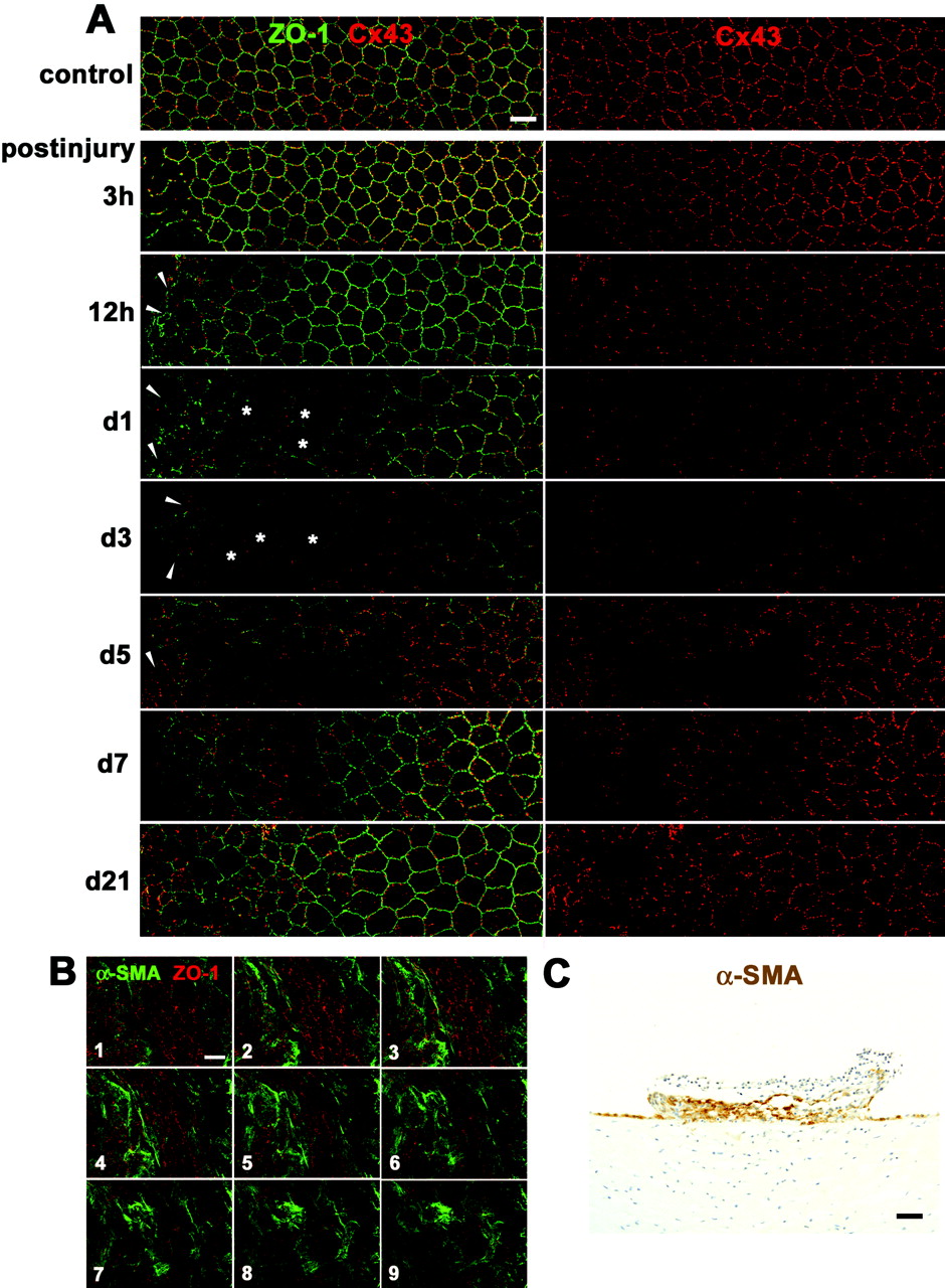 Changes in the rat corneal endothelium in vivo during wound healing after mechanical scrape injury with a 30-gauge needle. (A) Double immunolabeling for ZO-1 and Cx43 of a surface preparation (wounds on the left) during wound healing (3 hours to 21 days after injury) shows both enlarged corneal endothelial cells ( ) and multilayered small, elongated cells (arrowheads) and drastic changes in Cx43 expression in those cells. (B) Serial confocal images (1–9, from the surface to the deeper region) of double immunolabeling for ZO-1 and α-SMA taken at 0.7-μm intervals on day 5 after injury reveal that multilayered, small, elongated cells were α-SMA-positive myofibroblasts. (C) Immunohistochemistry for α-SMA using a cross section on day 5 after injury shows formation of a retrocorneal fibrous membrane consisting of α-SMA-positive myofibroblasts arranged in multiple cell layers posterior to Descemet’s membrane. Nuclei were stained with hematoxylin. Scale bars: (A, B) 20 μm; (C) 100 μm.