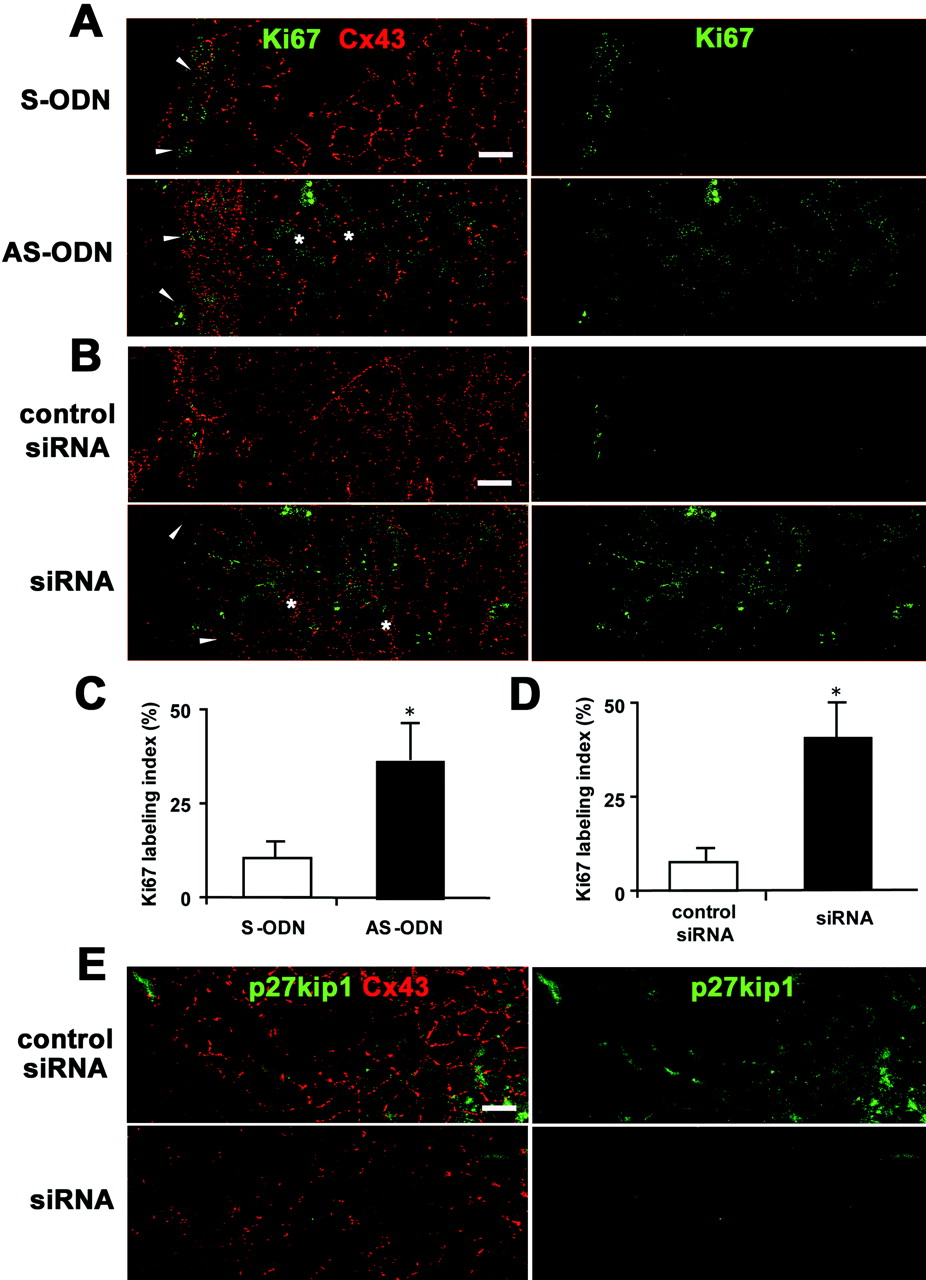 Cx43 AS-ODN or siRNA increased the proliferative activity of the rat corneal endothelium after scrape injury. (A, B) Double immunolabeling for Ki67 and Cx43 in a surface preparation on day 1 after injury (wounds on the left) revealed that not only small, elongated cells at the border of the wound (arrowheads), but also enlarged irregular-shaped endothelial cells ( ) on the periphery of the wound were Ki67-positive in the corneas treated with AS-ODN (A) or siRNA (B). In contrast, only small, elongated cells at the border of the wound were immunolabeled with Ki67 in the control eyes (S-ODN or control siRNA). (C, D) Ki67-labeling indexes in the corneas on day 1 after a single injection of AS-ODN (C) or siRNA (D) simultaneously with injury are shown. Mean ± SD; n = 5. *P < 0.001 versus control eyes (S-ODN or control siRNA); Student’s t-test. (E) Double immunolabeling for p27kip1 and Cx43 using surface preparations on day 1 after injury (wounds on the left) shows that Cx43 siRNA downregulated both p27kip1 and Cx43 expression. Scale bar, 20 μm.