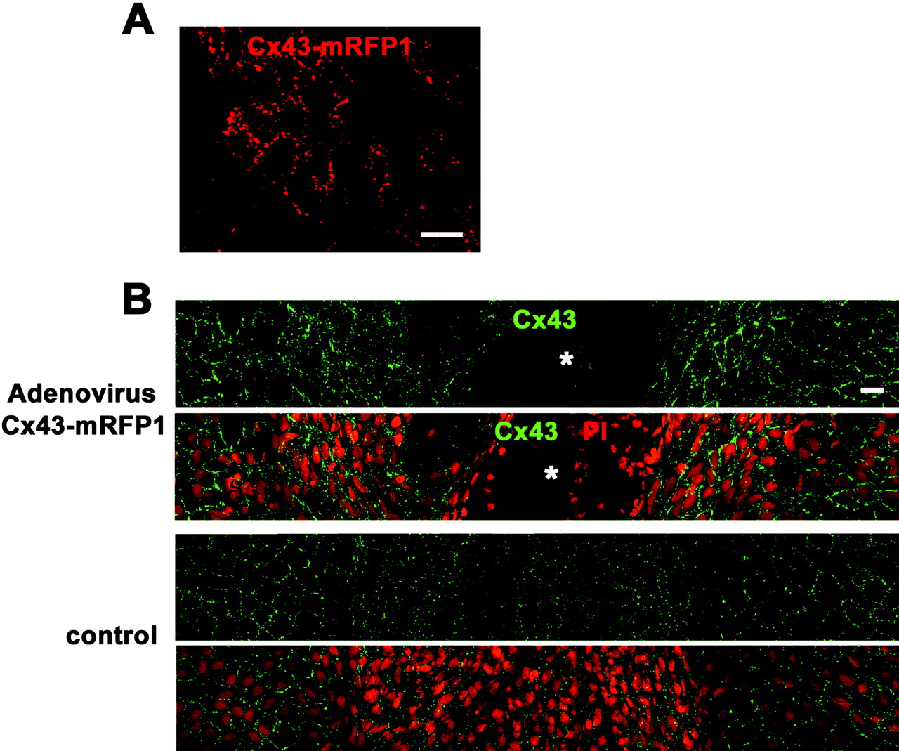 Cx43 overexpression by adenovirus containing CMV-Cx43-mRFP1 delayed wound closure of the rat corneal endothelium. (A) Cx43-mRFP1 fluorescence without fixation or any staining on day 3 after injection of 10 μL solution of recombinant adenovirus containing CMV-Cx43-mRFP (5 × 108 pfu/mL) into the anterior chamber without injury. Small, punctate Cx43-mRFP was seen between the endothelial cells. (B) Immunolabeling for Cx43 and nuclear staining with PI of a surface preparation on day 5 after injury (wounds at the center) revealed spaces without cells ( ) in the cornea treated with adenovirus containing CMV-Cx43-mRFP1, demonstrating that wound closure was not complete. In contrast, the control corneal surface was fully covered with endothelial cells without intervening spaces, indicating complete wound closure. Overexpression of Cx43 was seen in the corneal endothelium treated with adenovirus containing CMV-Cx43-mRFP1 compared with the control. Scale bar, 20 μm.