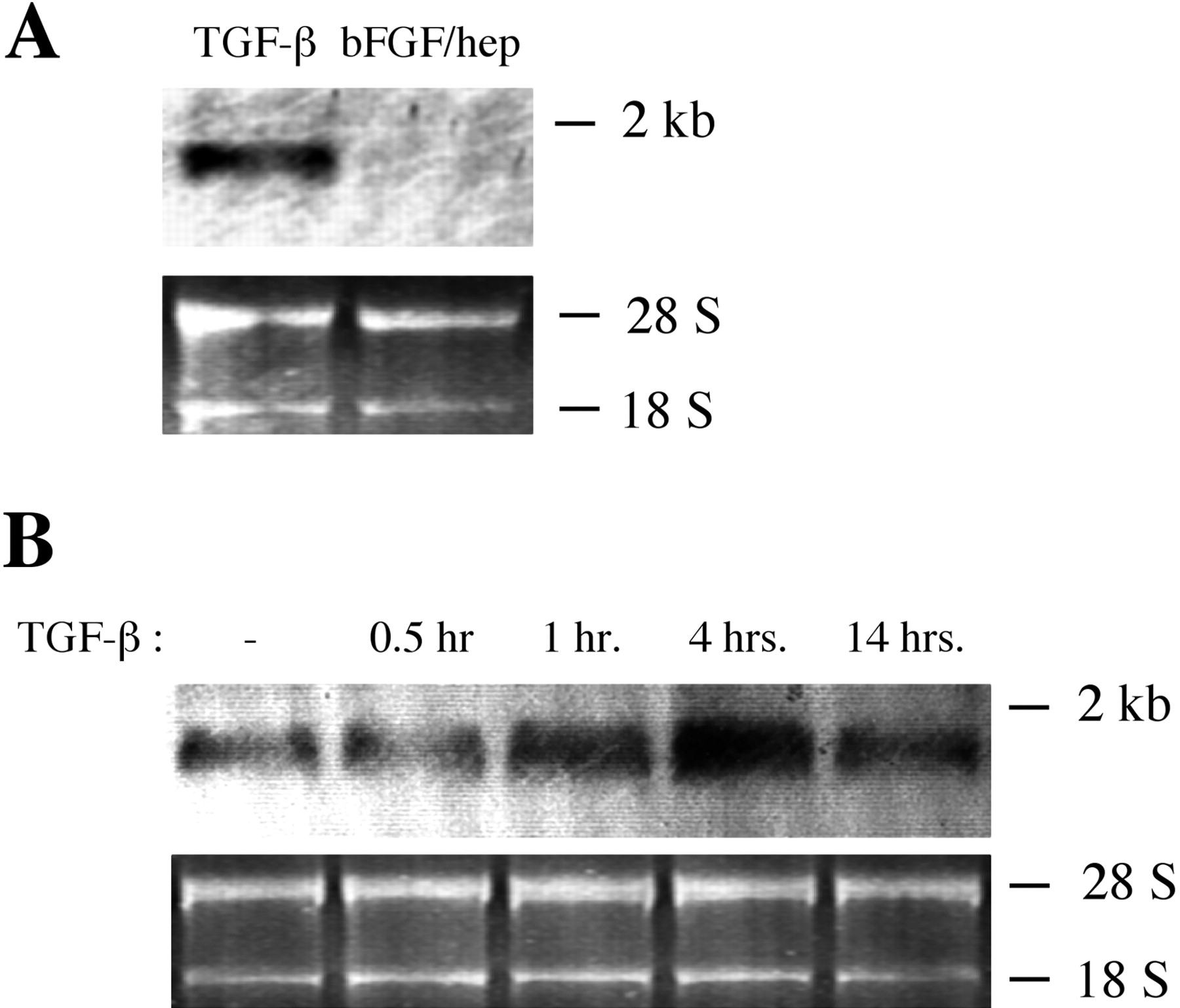 TGF-β1 induced an increase in α-SMA mRNA in retinal pericytes. Bovine retinal pericytes were cultured in 10% bovine calf serum/DMEM and were downshifted to 0.01% serum/DMEM for 48 hours. (A) Downshifted pericytes were cultured in the presence of either 1 ng/mL TGF-β1 or 5 ng/mL FGF-2+1 mg/mL heparin for 3 hours, and Northern blot analysis was performed on approximately 1 mg of RNA from each condition, using a 32P-labeled probe specific for α-SMA. (B) The cells were then cultured in the presence of 1 ng/mL TGF-β1 for the indicated lengths of time, and Northern blot analysis was performed, as in (A).