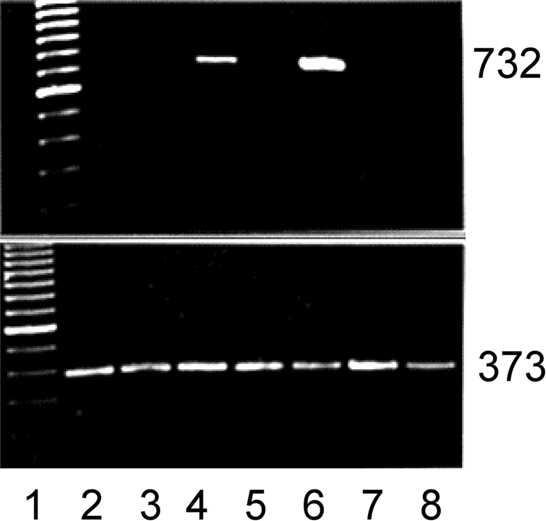 Myf-5 induction coincides with pericyte growth-arrest. Primers were designed, RNA purified and RT-PCR. Top: myf-5; bottom: β-actin. Lane 1: 100 bp ladder; lane 2: 10% calf serum; lane 3: FGF-2; lane 4: FGF-2 treatment before growth factor and serum withdrawal (0.2%); lane 5: FGF-2+heparin; lane 6: FGF-2+heparin treatment before growth factor and serum withdrawal; lane 7: endothelial cells; lane 8: vascular smooth muscle cells. Note the induction of the myf-5 PCR product (732 bp) after the withdrawal of FGF-2 or FGF-2 and heparin. Neither endothelial cells nor smooth muscle cells expressed myf-5. β-Actin control shows 373-bp PCR product. Ethidium bromide staining.