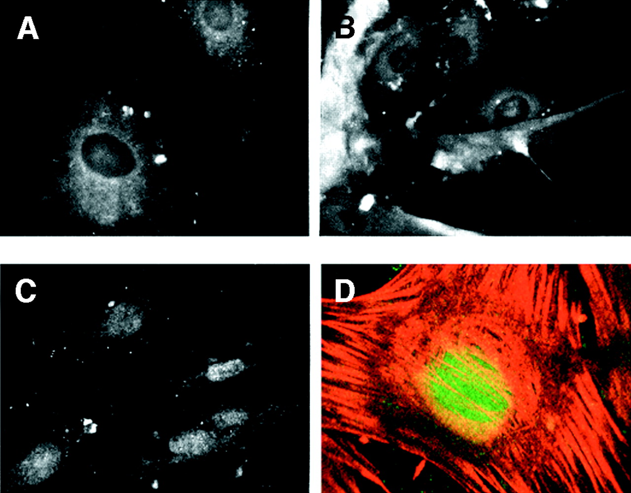 Myf-5 accumulated in the nucleus concomitant with growth arrest. Pericytes were grown in the presence of 10% serum or FGF-2/heparin. Cells were either maintained under these conditions or washed and changed to TGF-β1-containing medium. Cells were then fixed and prepared for anti-myf-5 immunofluorescence. When pericytes were cultured in the presence of serum (A) or FGF-2/heparin (B), anti-myf-5 fluorescence was cytoplasmic. However, after the switch from 10% serum to TGF-β1-containing medium (C), anti-myf-5 fluorescence was nuclear. Confocal imaging confirmed the nuclear localization of myf-5 in pericytes treated with TGF-β1 (D), and stained simultaneously for myf-5 (green) and α-SMA (red).