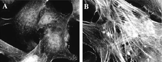 Addition of TGF-β1 induced pericyte expression of α-SMA. Shown are bovine retinal pericytes cultured as described and stained for α-SMA, after being grown in DMEM with 10% serum (A) or in low serum in the presence of 1 ng/mL TGF-β (B), which caused an increase in the formation of α-SMA-containing stress fibers.