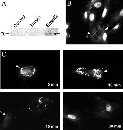 TGF-β1 induced Smad2 nuclear accumulation in retinal pericytes. (A) Western blot, performed on whole-cell lysates from transfected COS cells, demonstrating the specificity of rabbit anti-Smad2 antibody. (B) Bovine retinal pericytes were seeded onto glass coverslips and continuously grown in the presence of 10% serum. Arrowheads: diffuse cytoplasmic localization of Smad2. (C) Cells were grown in 10% serum and downshifted to 0.01% serum for 48 hours. The downshifted cells were then treated with 1 ng/mL TGF-β1 for the periods indicated. Arrowheads: punctate perinuclear staining of anti-Smad2; arrow: diffuse cytoplasmic Smad2 localization.
