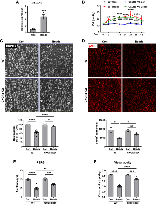 CXCR3 deletion was neuroprotective in the microbead-induced glaucomatous retina. (A) CXCL10 mRNA was measured at 5 days after microbead injection (n = 3–5). ***P < 0.001. (B) IOP of sham and microbead-injected eyes of WT and CXCR3 KO mice was measured at various time points (n = 10–12). *P < 0.05, **P < 0.01, ****P < 0.0001 compared with WT control (WT-Con); #P < 0.05, ###P < 0.001, and ####P < 0.0001 compared with CXCR3 KO control (KO-Con). (C) Retinal flatmounts were stained with anti-RBPMS to label RGCs at 6 weeks after microbead injection. Bar graph represents the quantification of RGC number. RGC numbers from eight images of the peripheral retina were counted and averaged as one sample (n = 7–9). (D) Optic nerve sections at 6 weeks after microbead injection were stained with anti-pNFH (red) to visualize axons. Bar graph represents the quantification of pNFH+ axons. Axon numbers from three to five images were counted and averaged as one sample (n = 3). (E, F) PERG (n = 5, 6) and visual acuity (n = 5 or 6) were measured at 6 weeks after microbead injection. Scale bar: 50 µm. *P < 0.05, **P < 0.01, ***P < 0.001, ****P < 0.0001; ns, not significant.