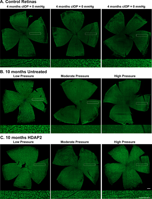 Retinal wholemounts from 4-month-old controls and 10-month-old animals. Wholemounts showing RBPMS-labeled RGCs from control animals and retinas from untreated and HDAP2-treated eyes at different cIOPs. Pressure categories: low = cIOP < 40 mm Hg; moderate = cIOP 40 to 80 mm Hg; and high = cIOP > 80 mm Hg. Higher magnification insets show representative RBPMS labeling. (A) Retinas from 4-month-old animals (cIOP = 0 mm Hg) showed normal RGC densities. (B) Untreated retinas showed normal RGC distributions at low pressure but progressive RGC loss with moderate and high IOP exposure. (C) HDAP2-treated retinas retained near-normal RGC density even at high pressure (cIOP = 116 mm Hg). Scale bars = 500 µm.